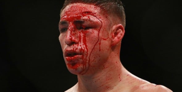 Diego Sanchez Tries To ‘Chael’ Himself into Fight with Benson Henderson