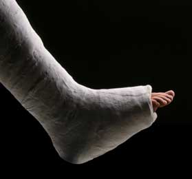 This leg break is not for the squeamish.